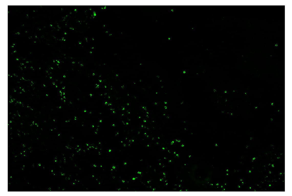 Immunohistochemistry Image 2: Granzyme B (D6E9W) & CO-0009-488 SignalStar<sup>™</sup> Oligo-Antibody Pair