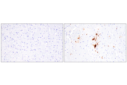 Immunohistochemistry Image 2: Galectin-3/LGALS3 (E7B6R) Rabbit mAb