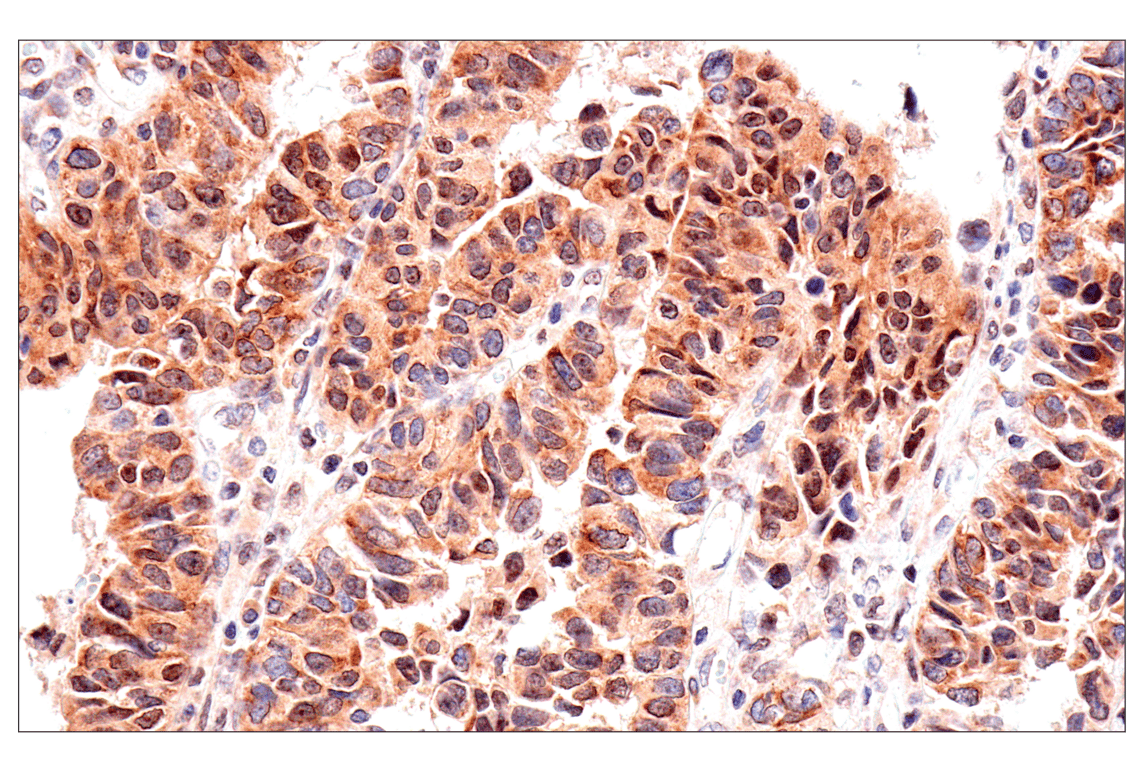 Immunohistochemistry Image 4: ADAR1 p150 Isoform (E6U1U) Rabbit mAb