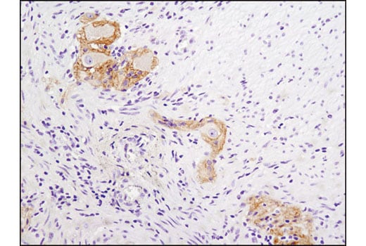 Immunohistochemistry Image 1: N-Cadherin (D4R1H) XP<sup>®</sup> Rabbit mAb
