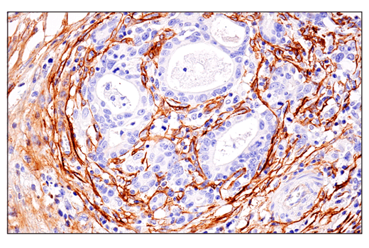 Immunohistochemistry Image 1: CD248 (E9Z7O) XP<sup>®</sup> Rabbit mAb