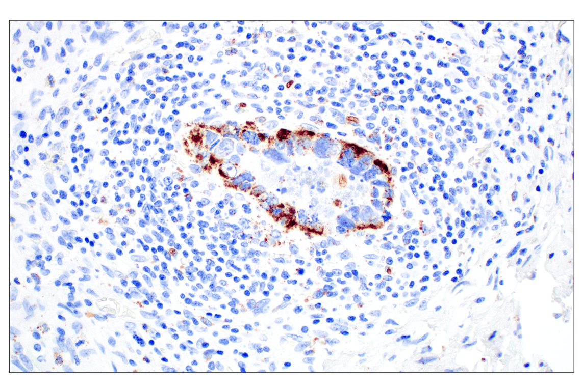 Immunohistochemistry Image 9: Perilipin-2 (E6G6M) Rabbit mAb