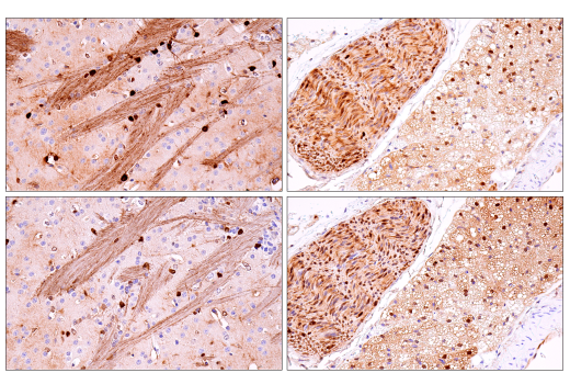 Immunohistochemistry Image 4: S100B (E9F2I) Rabbit mAb (BSA and Azide Free)