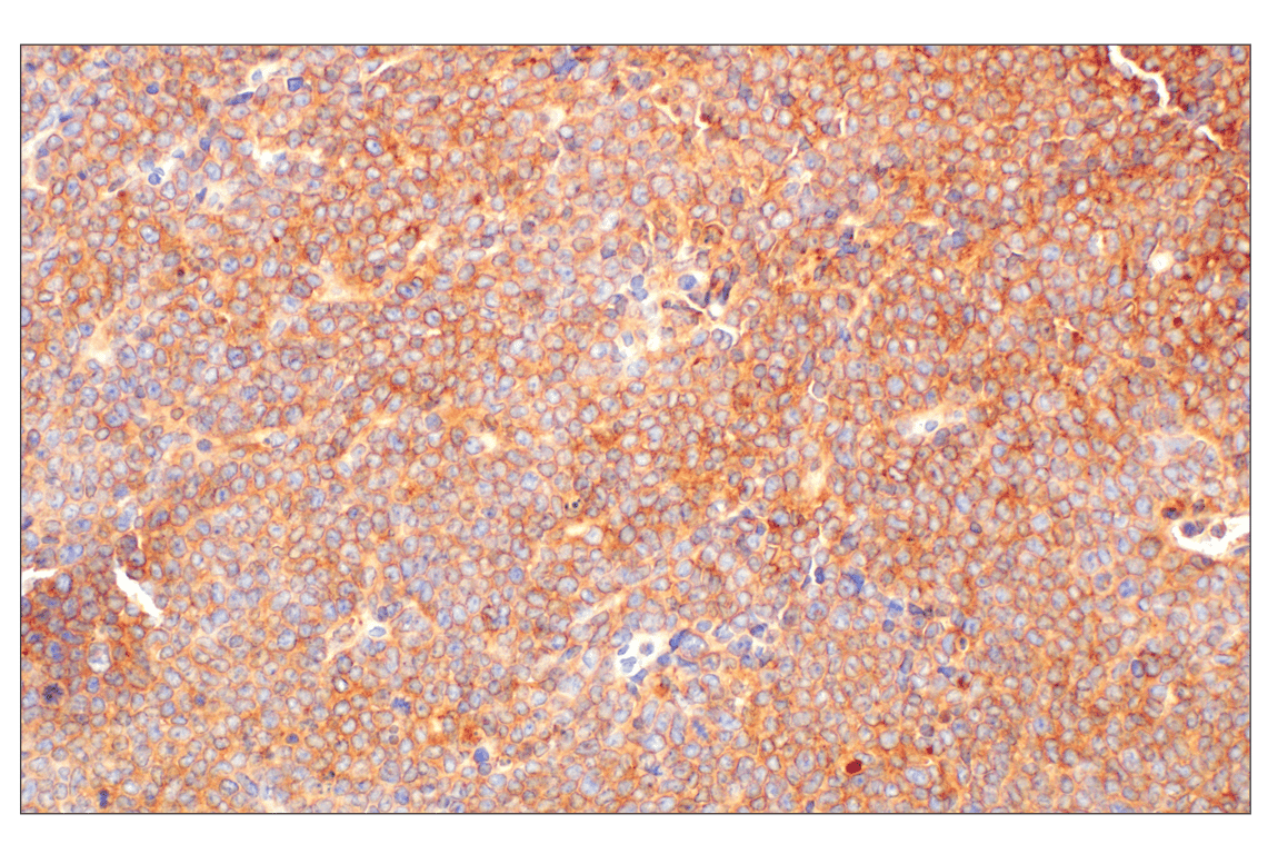 undefined Image 18: Rho-GTPase Antibody Sampler Kit
