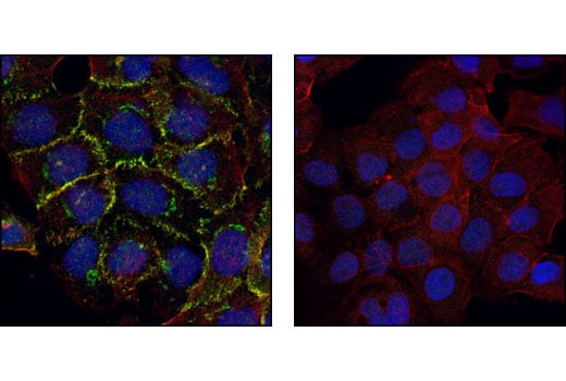 Immunofluorescence Image 1: α-E-Catenin Antibody