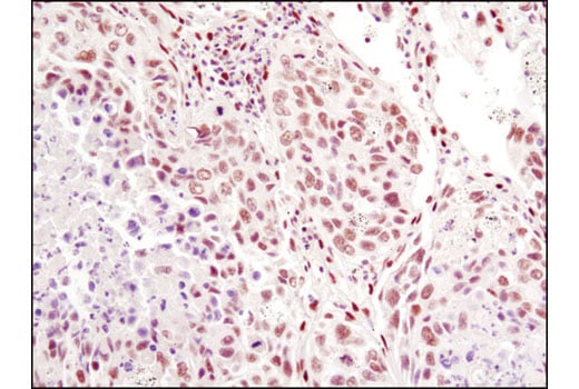 Immunohistochemistry Image 2: CtBP1 (D2D6) Rabbit mAb