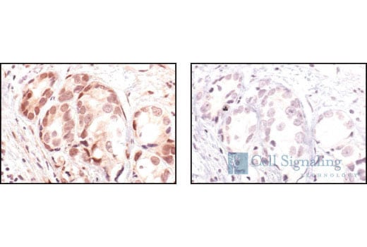 Immunohistochemistry Image 4: Phospho-Akt (Ser473) (736E11) Rabbit mAb