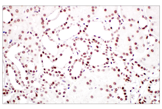 Immunohistochemistry Image 5: METTL3 (E3F2A) Rabbit mAb (BSA and Azide Free)