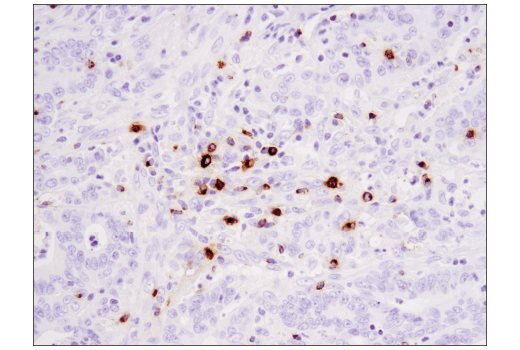 undefined Image 70: Human Exhausted CD8<sup>+</sup> T Cell IHC Antibody Sampler Kit