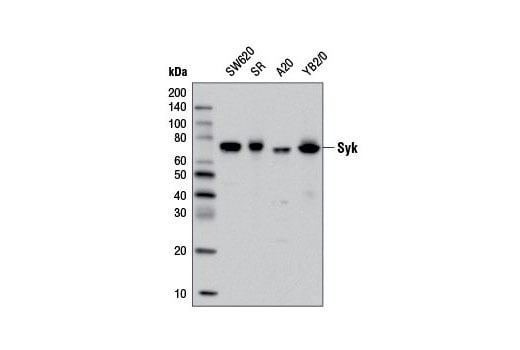 Western Blotting Image 1: Syk (D3Z1E) XP<sup>®</sup> Rabbit mAb (BSA and Azide Free)