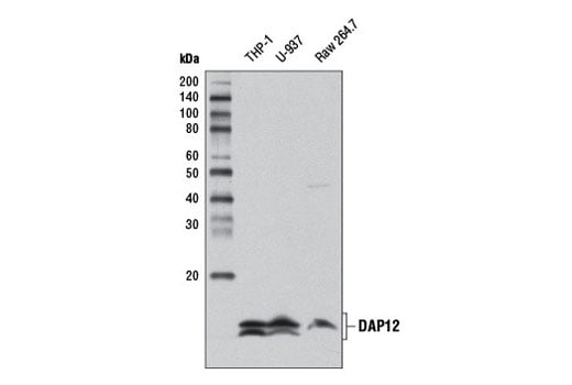 Western Blotting Image 1: DAP12 (D7G1X) Rabbit mAb (Biotinylated)