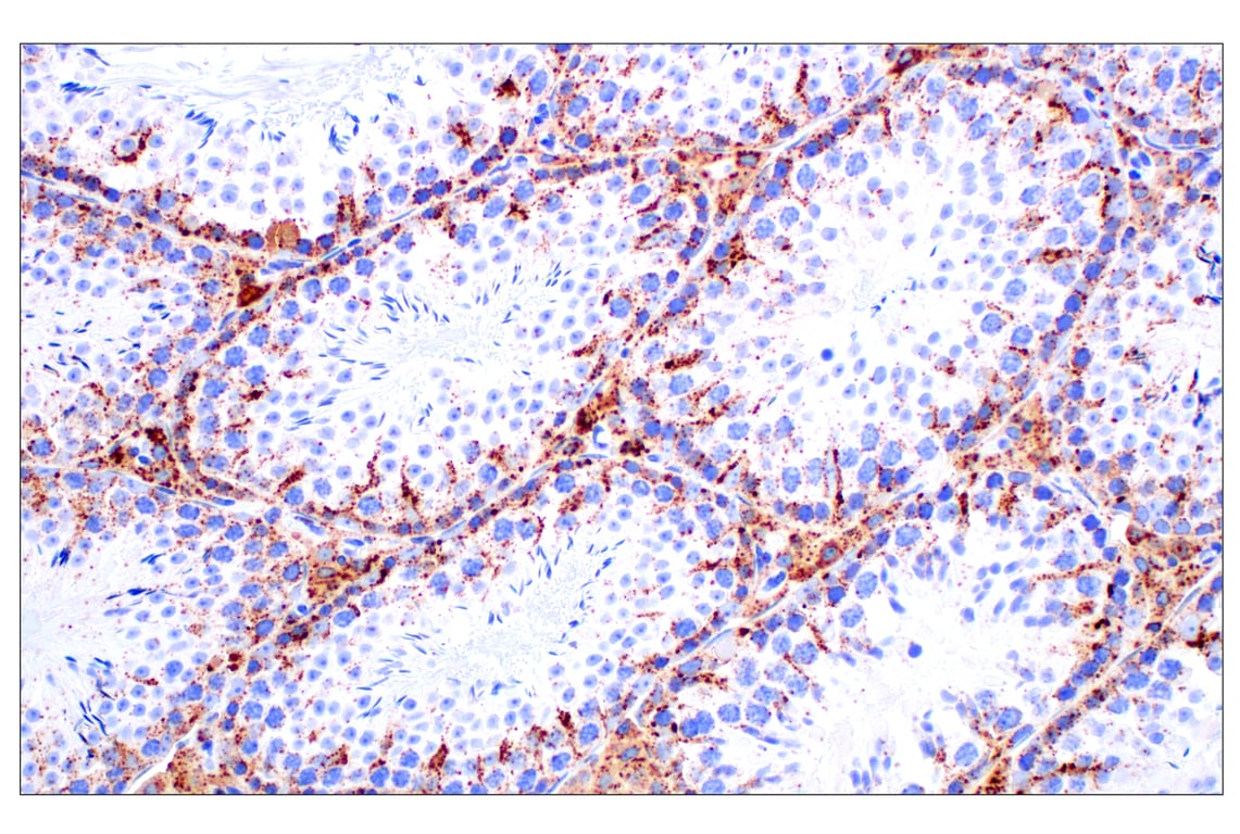 Immunohistochemistry Image 10: Cathepsin D (E5V4H) Rabbit mAb