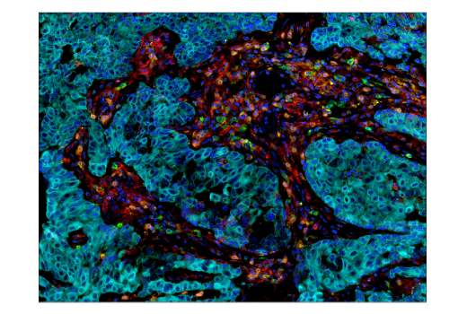 Immunohistochemistry Image 4: TIM-3 (D5D5R<sup>™</sup>) XP<sup>®</sup> Rabbit mAb (BSA and Azide Free)