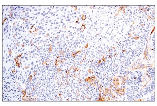 Immunohistochemistry Image 1: CD54/ICAM-1 (E3Q9N) XP<sup>®</sup> Rabbit mAb