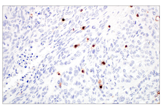 Immunohistochemistry Image 3: CD7 (E4G1Q) XP<sup>®</sup> Rabbit mAb (BSA and Azide Free)