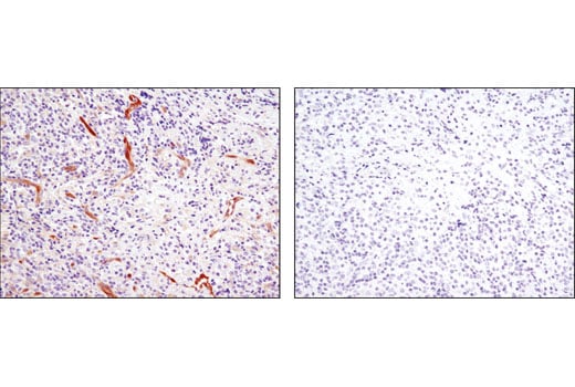 Immunohistochemistry Image 3: NDRG1 (D8G9) XP<sup>®</sup> Rabbit mAb