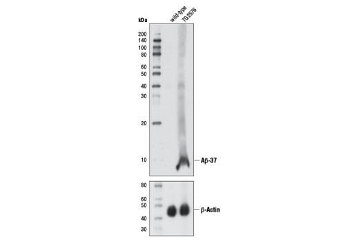 Western Blotting Image 3: β-Amyloid (1-37) (D2A6H) Rabbit mAb (Biotinylated)