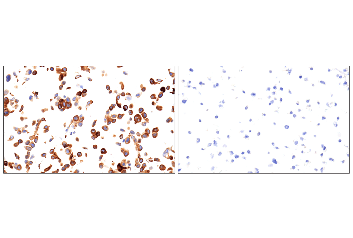 Immunohistochemistry Image 2: ROS1 (D4D6<sup>®</sup>) Rabbit mAb (Autostainer Formulated)