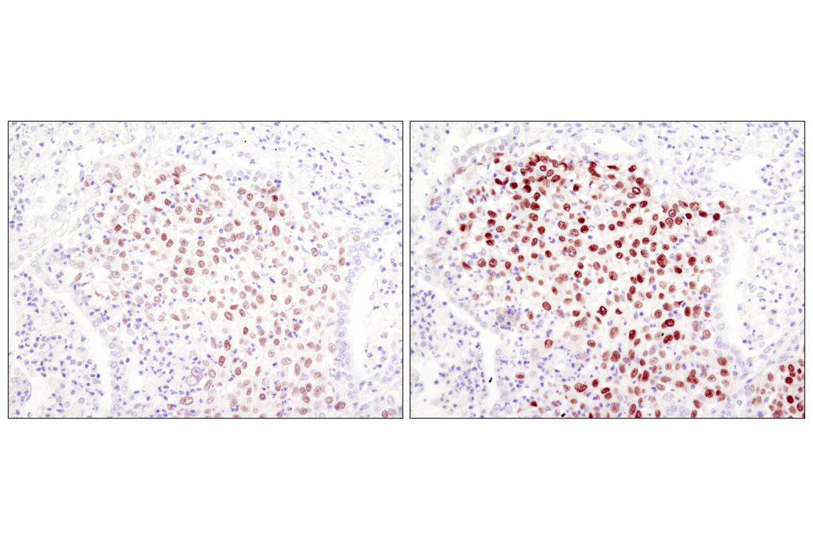 Immunohistochemistry Image 1: SignalStain® Boost IHC Detection Reagent (HRP, Rabbit)