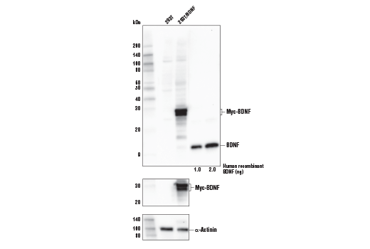 Western Blotting Image 1: BDNF Antibody