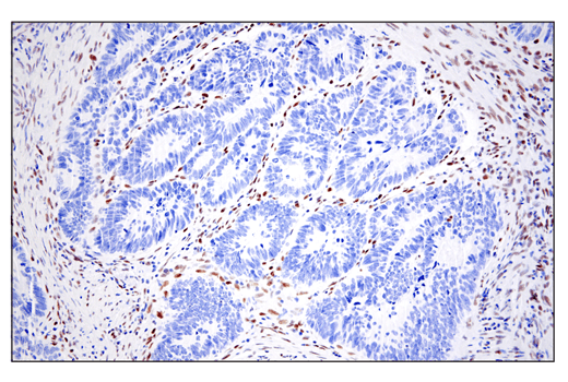 undefined Image 55: Epithelial-Mesenchymal Transition (EMT) IF Antibody Sampler Kit