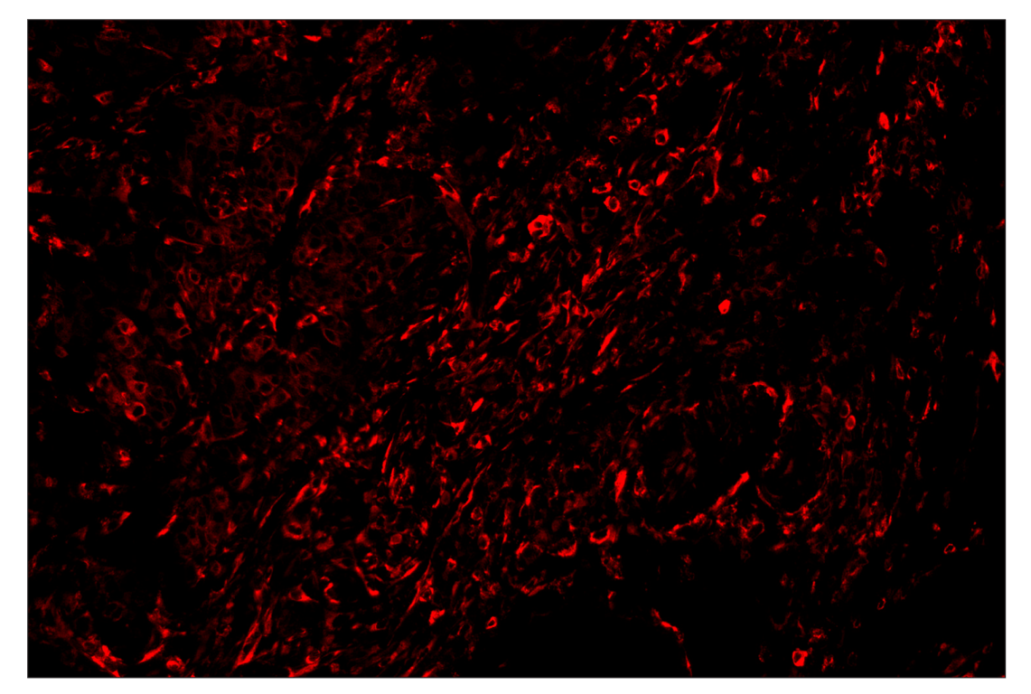 Immunohistochemistry Image 3: Phospho-S6 Ribosomal Protein (Ser235/236) (D57.2.2E) & CO-0107-488 SignalStar<sup>™</sup> Oligo-Antibody Pair