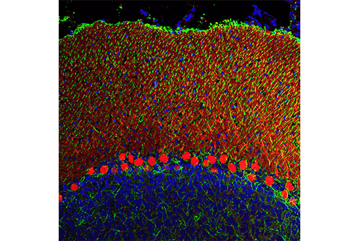 Immunofluorescence Image 1: Calbindin (D1I4Q) XP<sup>®</sup> Rabbit mAb (Alexa Fluor<sup>®</sup> 594 Conjugate)