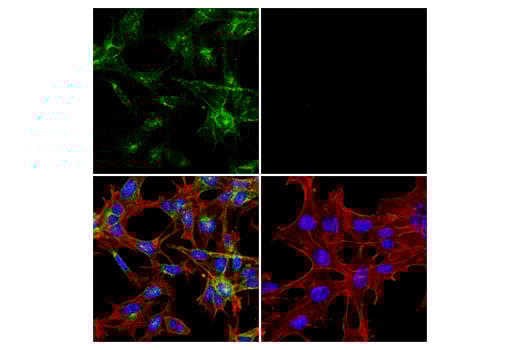 undefined Image 20: LRP1-mediated Endocytosis and Transmission of Tau Antibody Sampler Kit