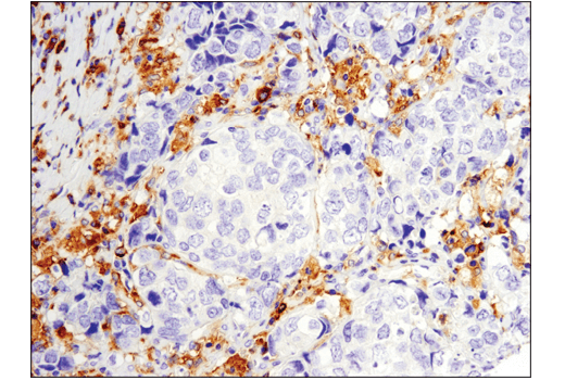 undefined Image 4: PhosphoPlus<sup>®</sup> Btk (Tyr223) Antibody Duet