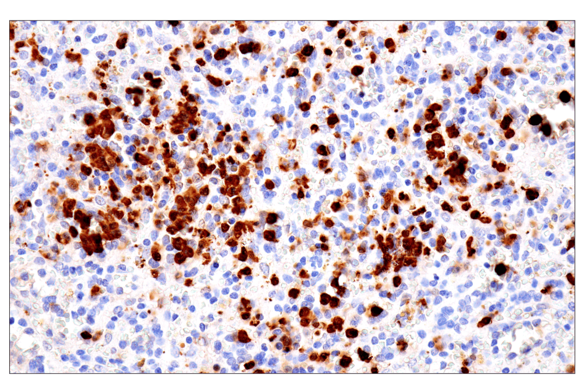 Immunohistochemistry Image 7: S100A8 (F4R2W) Rabbit mAb (BSA and Azide Free)