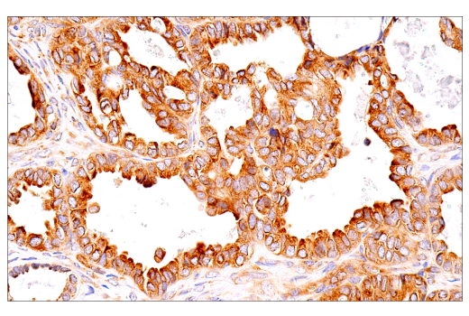 Immunohistochemistry Image 7: G3BP1 (E9G1M) XP<sup>®</sup> Rabbit mAb