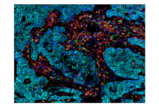 Immunohistochemistry Image 4: PD-1 (Intracellular Domain) (D4W2J) XP<sup>®</sup> Rabbit mAb