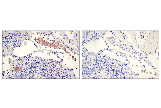 Immunohistochemistry Image 3: CD86 (E2G8P) Rabbit mAb (BSA and Azide Free)