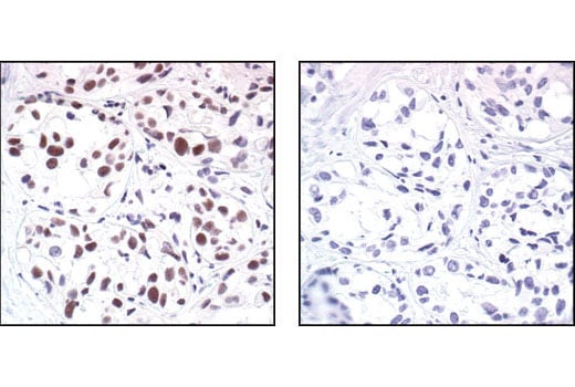 Immunohistochemistry Image 2: Mre11 Antibody