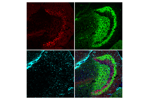 Immunofluorescence Image 2: Calretinin (E7R6O) XP<sup>®</sup> Rabbit mAb