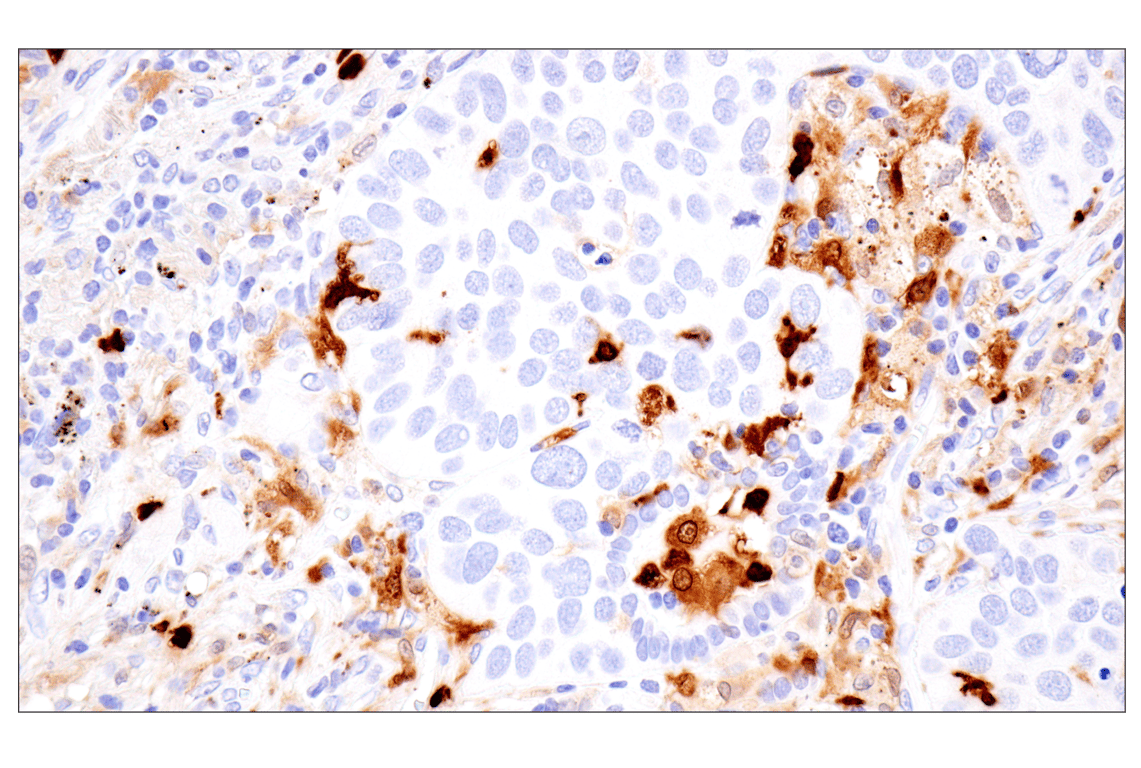 Immunohistochemistry Image 5: S100A8 (F4R2W) Rabbit mAb (BSA and Azide Free)