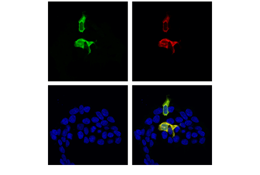 Immunofluorescence Image 1: Cas9 (<i>S. pyogenes</i>) (E7M1H) XP<sup>®</sup> Rabbit mAb (BSA and Azide Free)