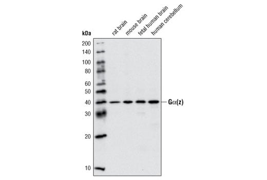 Western Blotting Image 1: Gα(z) Antibody