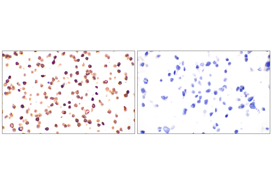 Immunohistochemistry Image 4: CD20 (E3N7O) XP<sup>®</sup> Rabbit mAb (BSA and Azide Free)