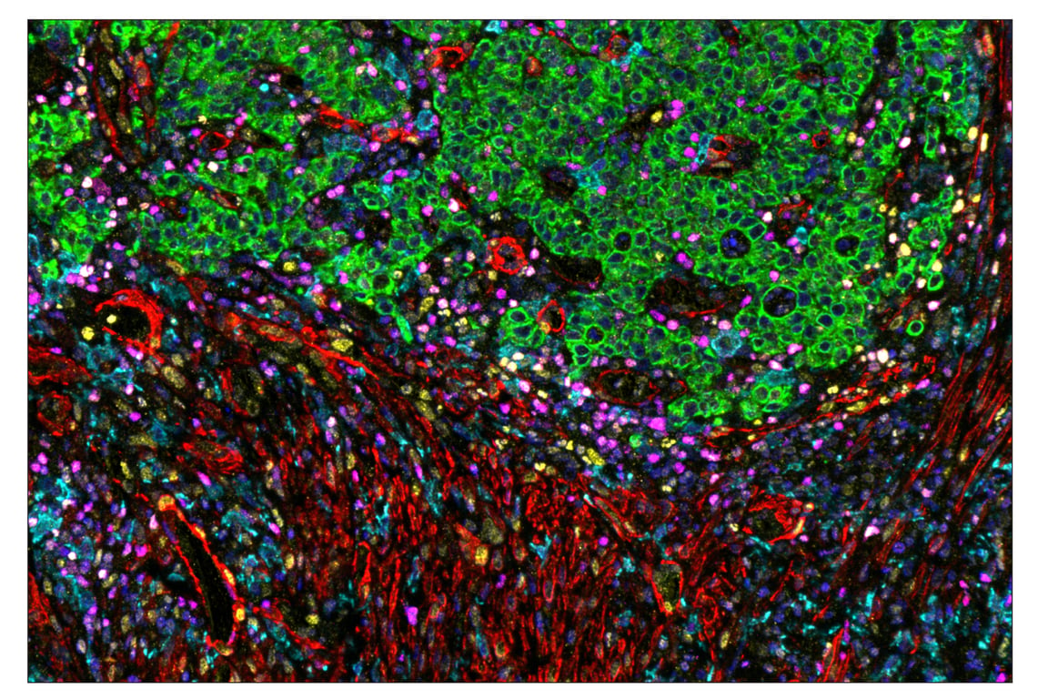 Immunohistochemistry Image 1: Tox/Tox2 (E6I3Q) & CO-0016-750 SignalStar<sup>™</sup> Oligo-Antibody Pair