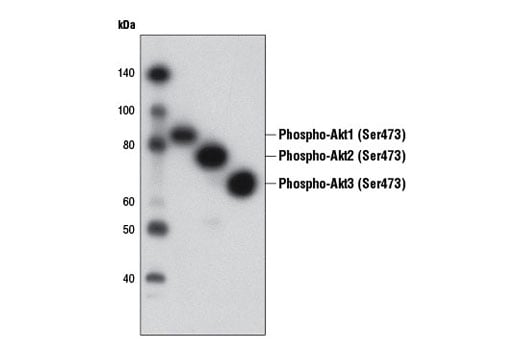 Western Blotting Image 3: Phospho-Akt (Ser473) (D9W9U) Mouse mAb