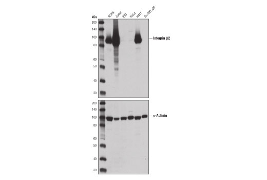 undefined Image 8: YAP/TAZ Transcriptional Targets Antibody Sampler Kit