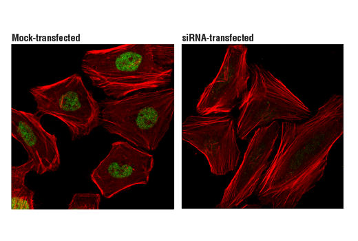 Immunofluorescence Image 1: LRF/Pokemon (D7U2O) Rabbit mAb