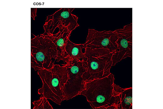 Immunofluorescence Image 1: Menin (D45B1) XP<sup>®</sup> Rabbit mAb