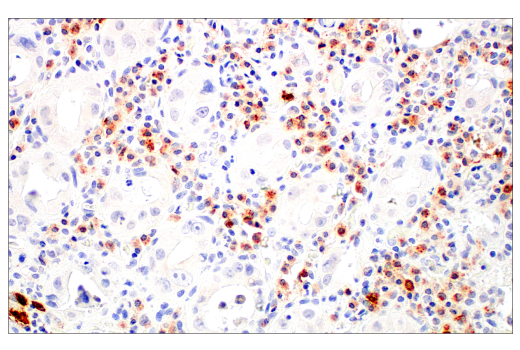 Immunohistochemistry Image 1: LAMP3/CD208 (E6E5U) XP<sup>®</sup> Rabbit mAb (BSA and Azide Free)