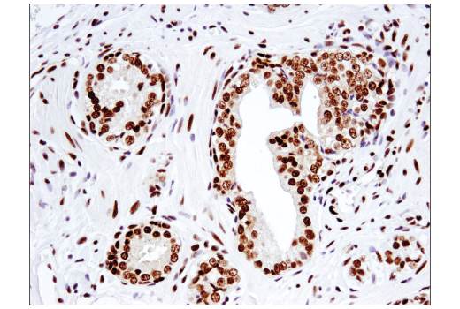 undefined Image 55: BAF Complex IHC Antibody Sampler Kit