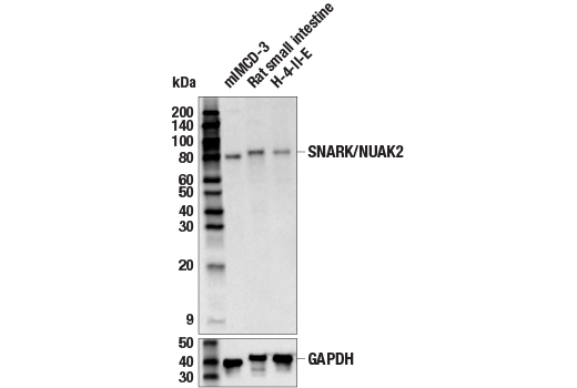 Western Blotting Image 1: SNARK/NUAK2 (E4V4Q) Rabbit mAb