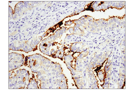 Immunohistochemistry Image 1: CD133 (D2V8Q) XP<sup>®</sup> Rabbit mAb (BSA and Azide Free)