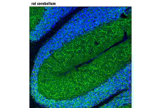 Immunofluorescence Image 1: MAP2 (D5G1) XP<sup>®</sup> Rabbit mAb