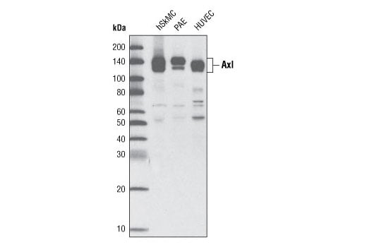 Western Blotting Image 2: Axl (C44G1) Rabbit mAb